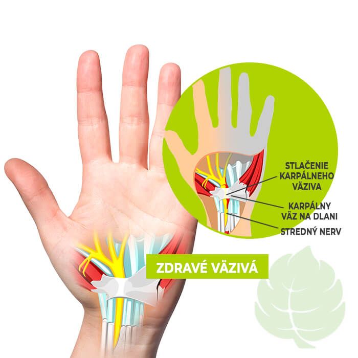 hillvital karpalny tunel anatomia infografika salikort